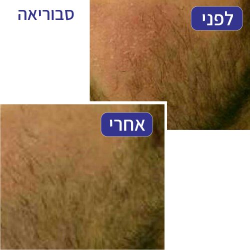 סבוריאה - חני רוזנברג